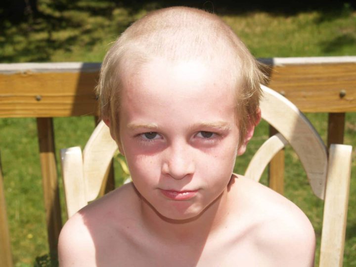 Brave Child Shaves Head in Solidarity With Balding Father