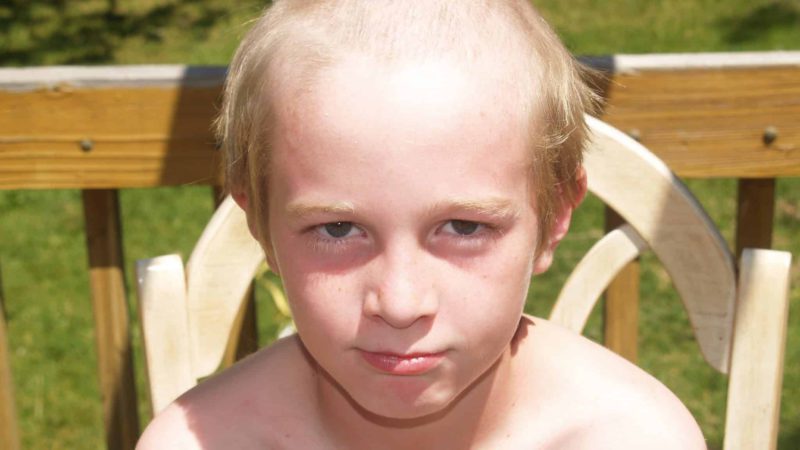 Brave Child Shaves Head in Solidarity With Balding Father